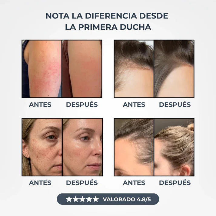 Cabezal De Ducha Con Filtro Antical y Anticloro Para Cuidar Tu Piel y Tu Cabello.